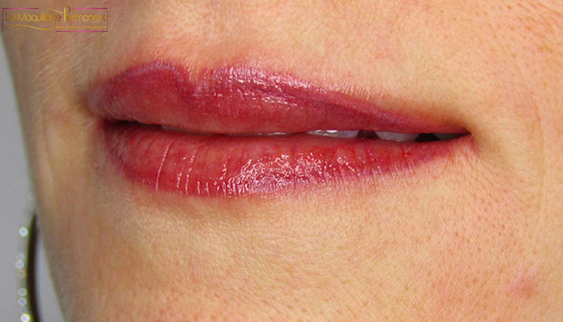 Le maquillage permanent des lèvres — après