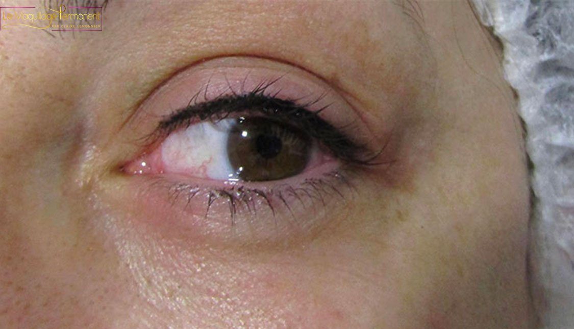 Le maquillage permanent des yeux — après